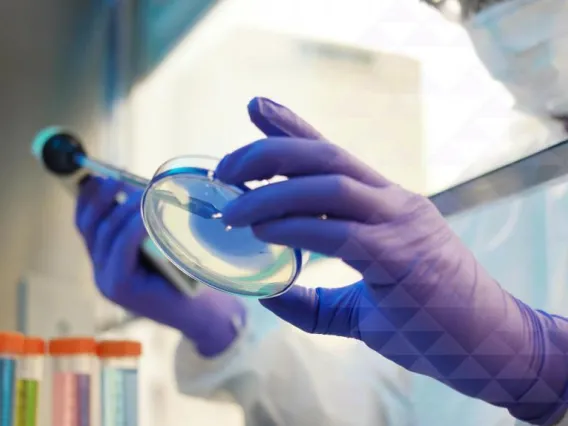Scientist looking at a pitri dish